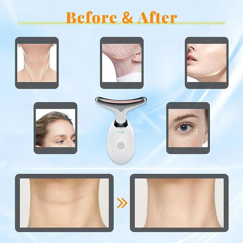 Appareil de beauté du cou et du visage, resserrement de la peau, appareil de lifting du visage, outil de soins de la peau, SAP, double ruisseau LeRameauShop