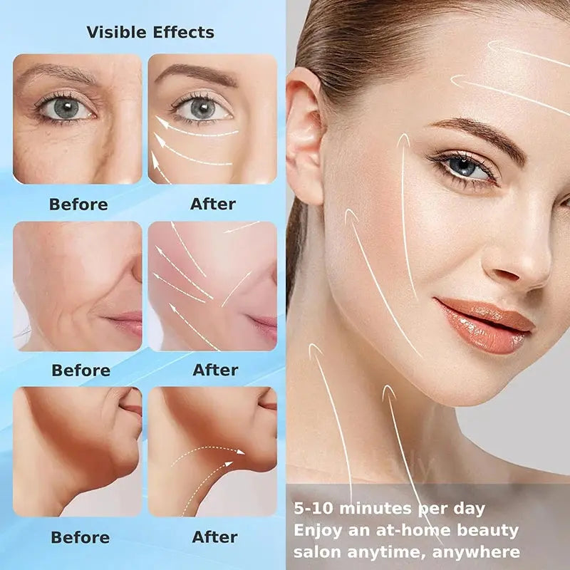 Appareil de beauté du cou et du visage, resserrement de la peau, appareil de lifting du visage, outil de soins de la peau, SAP, double ruisseau LeRameauShop